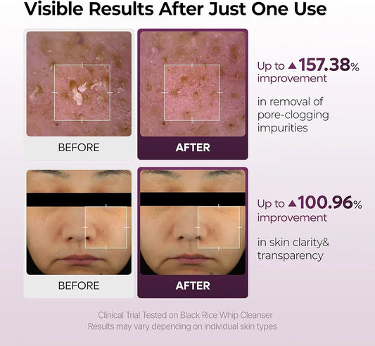 Dr melaxin black rice cleanser